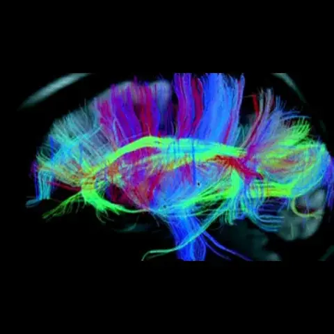 هل بات إختراع آلة لقراءة الأحلام وشيكاً ؟