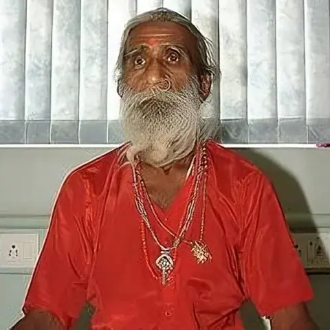 قدرة خارقة على تحمل الجوع