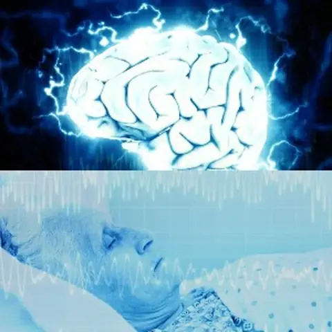 حل لغز نشاط الدماغ بعد الموت : ماذا يحدث خلال الثلاثين ثانية ؟