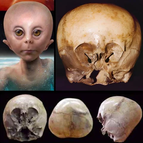 جمجمة ستارتشايلد: جنس أرضي أم هجين خارجي ؟