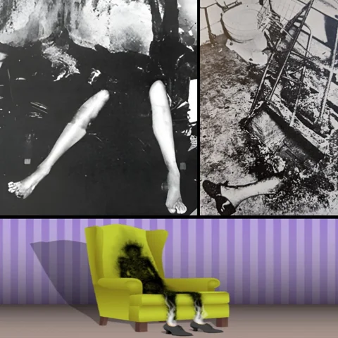 ظاهرة SHC النادرة - الاحتراق البشري الذاتي