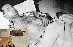 تعرض ميكالاك لحروق شديدة على صدره ويديه بعد أن لمس الطبق الطائر وأثناء إقلاعه