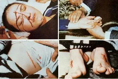 آثار الصلب Stigmata التي ظهرت على ميرنا الأخرس ، تلك الآثار التي يعتقد المسيحيون أنها ظهرت خلال صلب السيد المسيح، فتاج الشوك أدمى جبهته وكذلك أدمت المسامير المغروسة في راحتي يديه وفي قدميه. أضافة إلى ذلك ظهر جرحاً في جانب من بطنها. حدث ذلك في عيد الفصح من يوم الأحد الذي تطابق فيه عيد طائفتين هما الأرثوذكس والرومان الكاثوليك.