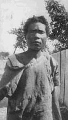 صورة حقيقة لشخص هاييتي تم تحويله الى زومبي